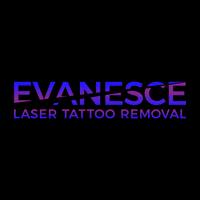 Evanesce Laser Tattoo Removal